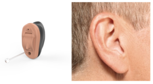 IIC – invisible in the canal hearing aid